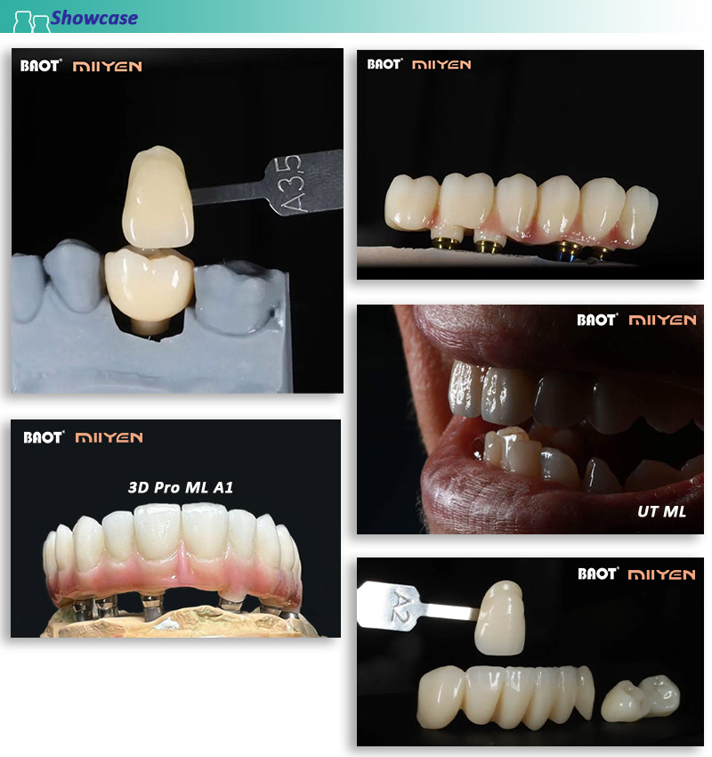 Dental Lab Material Zirconia Block showcase