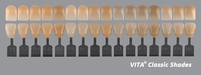 UT دليل الظل كتلة زركونيا متعدد الطبقات في طب الأسنان