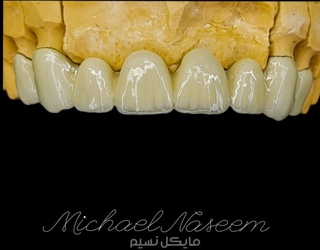 dental ceramic for crown and bridge