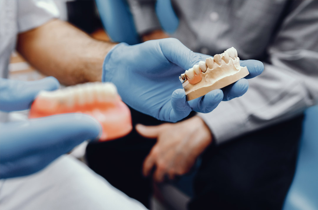 كتلة زركونيا الأسنان لاستخدام ترميم الأسنان