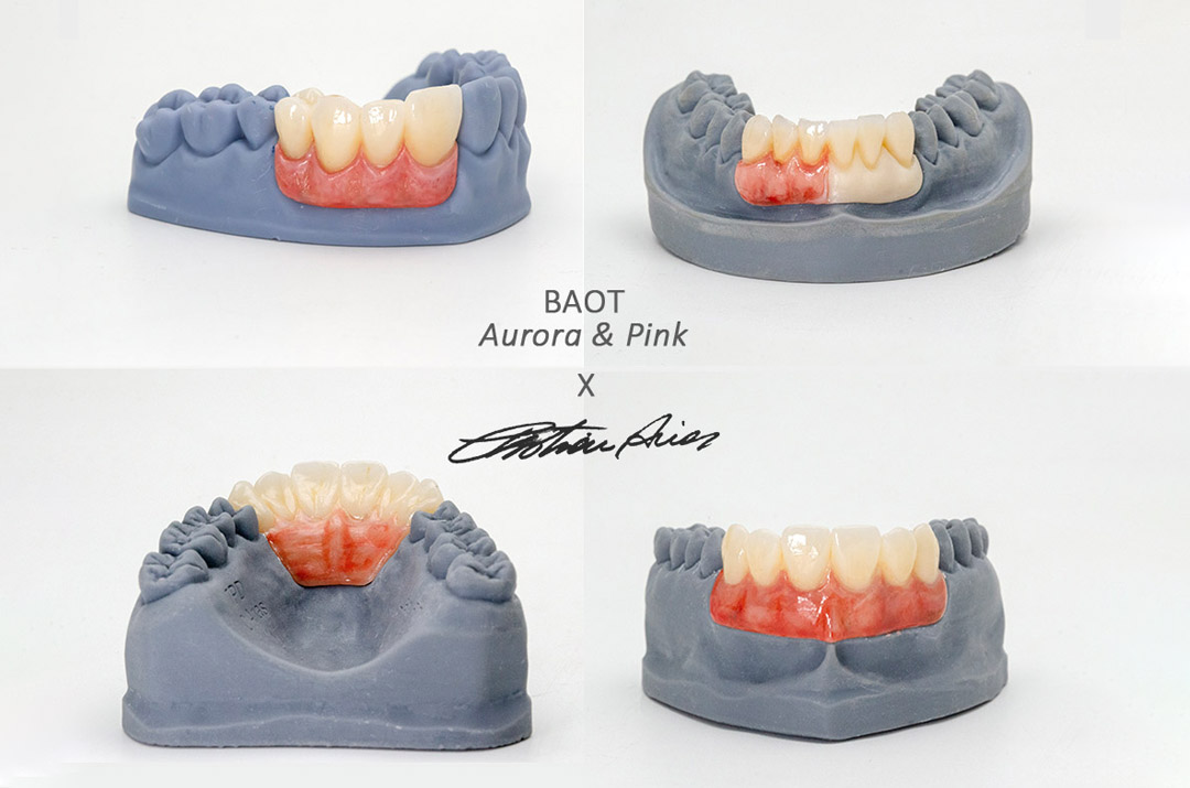 نصائح BAOT Aurora Dental Stain Glaze