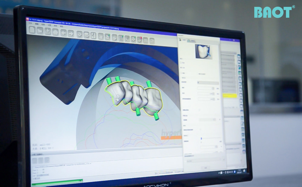 CAD/CAM Design of Zirconia Dental Crown For Digital Dentistry Application CAD/CAM Design of Zirconia Dental Crown For Digital Dentistry Application