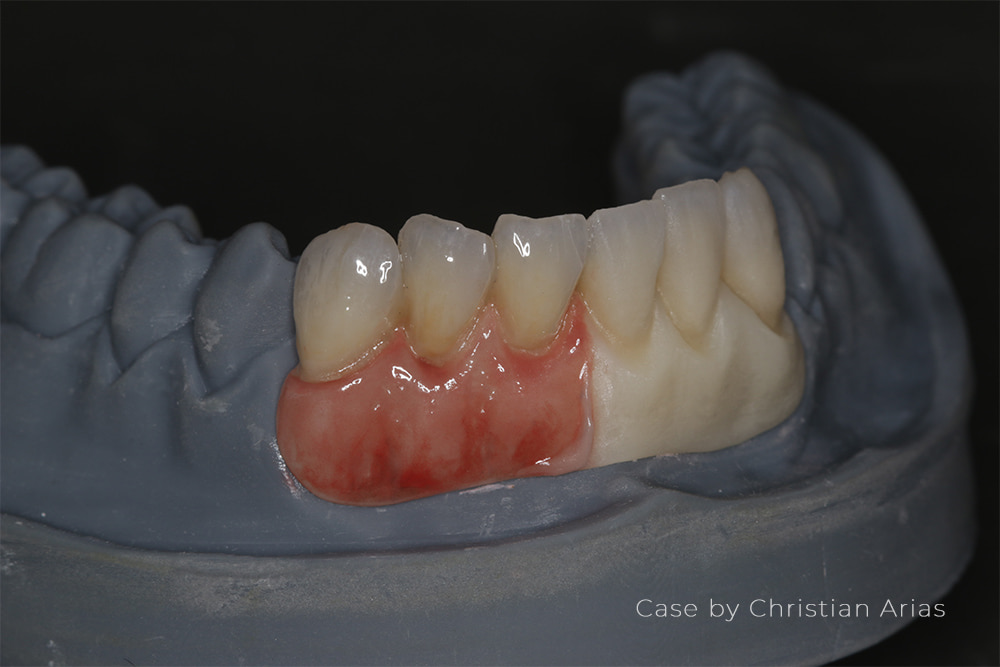 Dental Stain Glaze Structure Kit for Lab