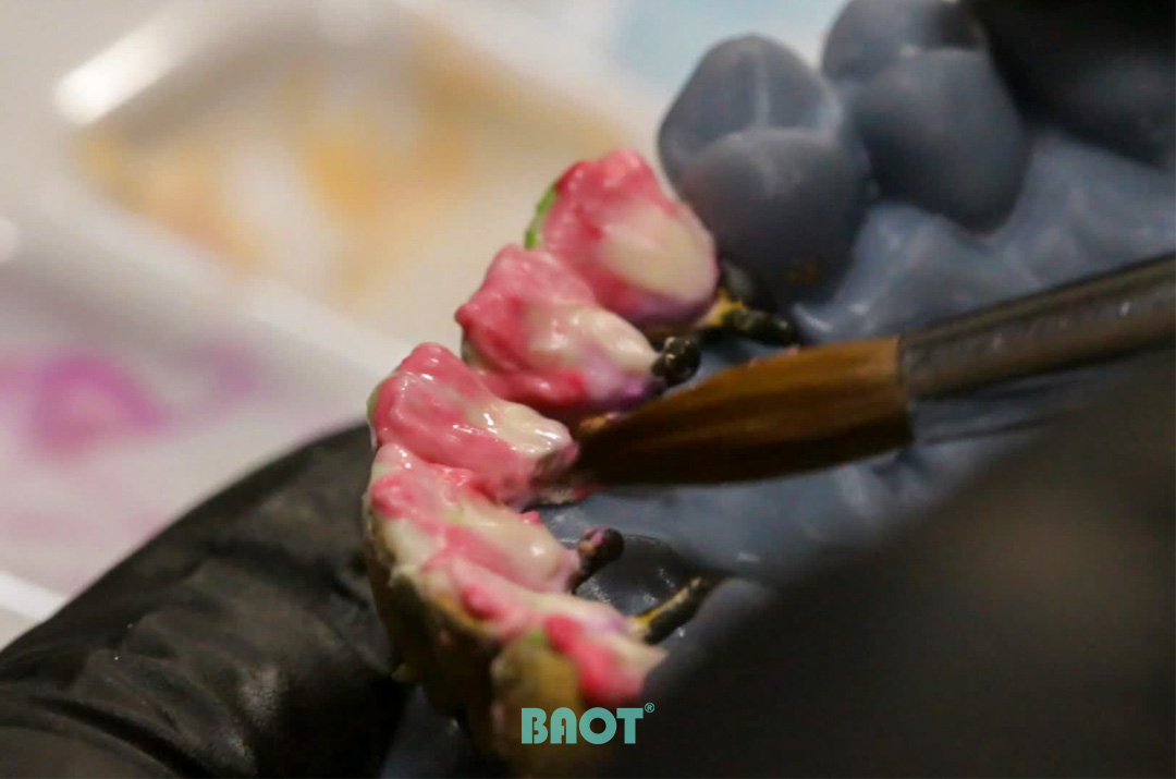 كيف تتجنب مشاكل الجودة الشائعة لأسنان البورسلين؟